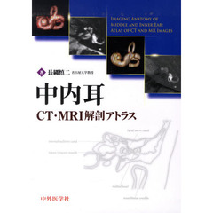 中内耳ＣＴ・ＭＲＩ解剖アトラス