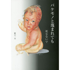 バケモノと蔑まれても　死なないで