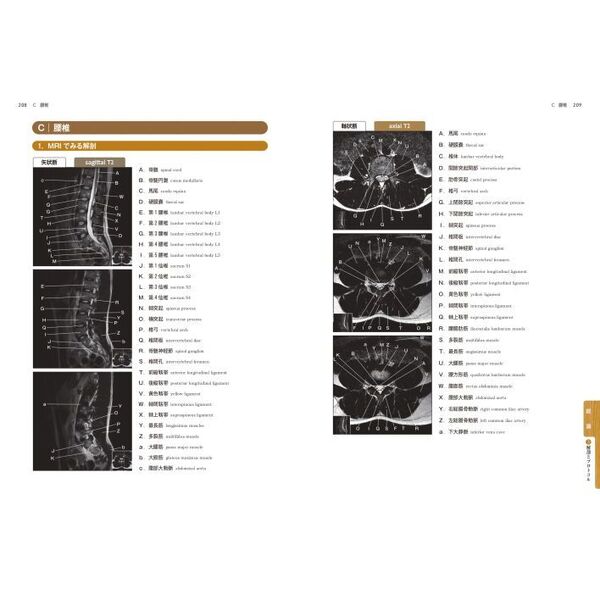 脊椎ＭＲＩ読影の一手　１９０５画像からみた定跡
