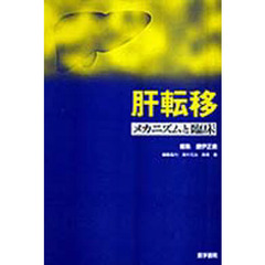 肝転移－メカニズムと臨床