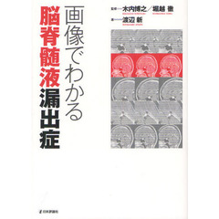 画像でわかる脳脊髄液漏出症