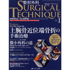 整形外科サージカルテクニック　手術が見える・わかる専門誌　第４巻１号（２０１４－１）　基本手術と合併症対策上腕骨近位端骨折の手術治療