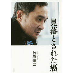 見落とされた癌