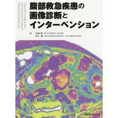 腹部救急疾患の画像診断とインターベンション