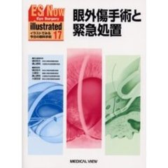 ＥＳ　ｎｏｗ　ｉｌｌｕｓｔｒａｔｅｄ　イラストでみる今日の眼科手術　１７　眼外傷手術と緊急処置