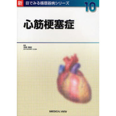 心筋梗塞症