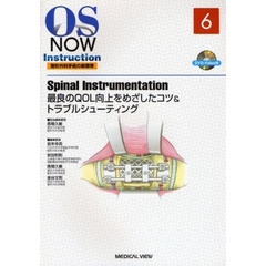 ＳｐｉｎａｌＩｎｓｔｒｕｍｅｎｔａｔｉｏ