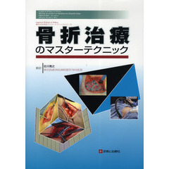 骨折治療のマスターテクニック
