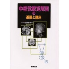 中枢性聴覚障害の基礎と臨床