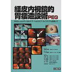 経皮内視鏡的胃瘻造設術ＰＥＧ　ＰＥＧによるメディカルケア・ヘルスケア・ライフケアを目指して