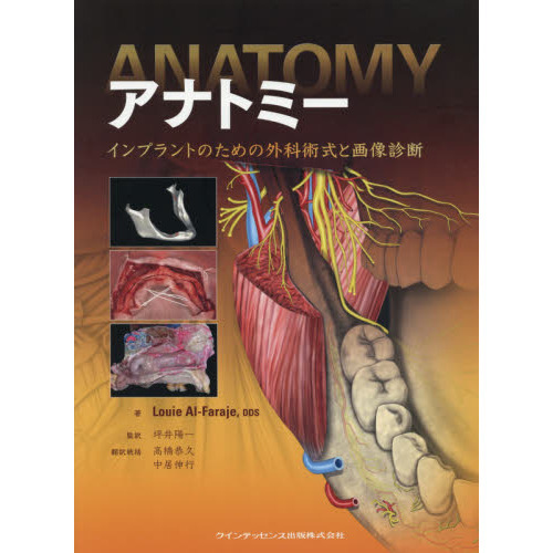 アナトミー　インプラントのための外科術式と画像診断