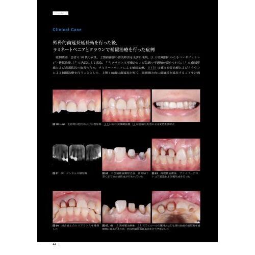 The Tooth Preparation自然医療薬学健康