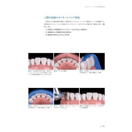 Ｔｈｅ　Ｔｏｏｔｈ　Ｐｒｅｐａｒａｔｉｏｎ　補綴修復治療の成功を目指した支台歯形成