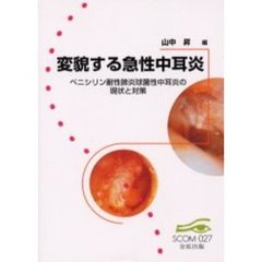 変貌する急性中耳炎　ペニシリン耐性肺炎球菌性中耳炎の現状と対策