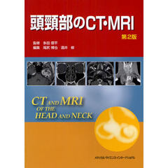 頭頸部のＣＴ・ＭＲＩ　第２版