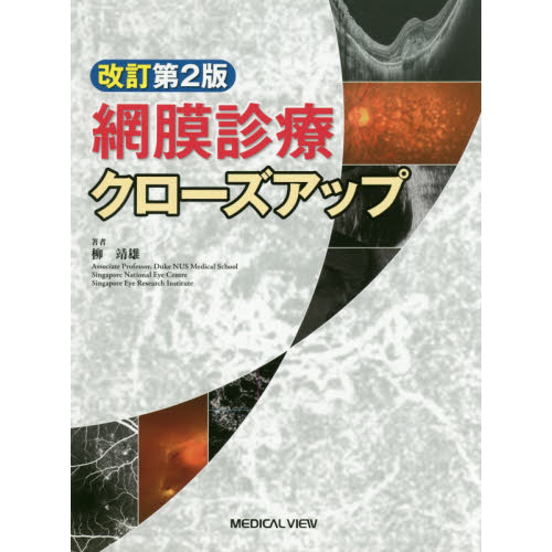 最新最全の 網膜診療クローズアップ 第2版 改定第2版 改訂第2版 裁断済 