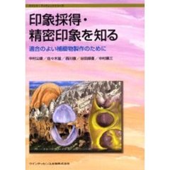 印象採得・精密印象を知る　適合のよい補綴物製作のために