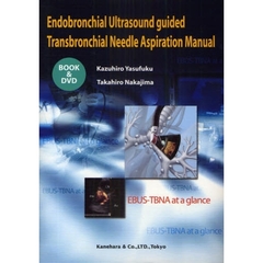Ｅｎｄｏｂｒｏｎｃｈｉａｌ　Ｕｌｔｒａｓｏｕｎｄ　ｇｕｉｄｅｄ　Ｔｒａｎｓｂｒｏｎｃｈｉａｌ　Ｎｅｅｄｌｅ　Ａｓｐｉｒａｔｉｏｎ　Ｍａｎｕａｌ　ＥＢＵＳ－ＴＢＮＡ　ａｔ　ａ　ｇｌａｎｃｅ