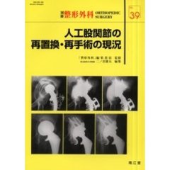 人工股関節の再置換・再手術の現況
