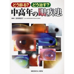 どう診る？どう治す？中高年の眼疾患