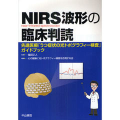 ＮＩＲＳ波形の臨床判読　先進医療「うつ症状の光トポグラフィー検査」ガイドブック