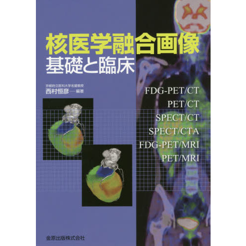 核医学融合画像　基礎と臨床