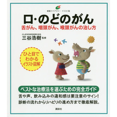口・のどのがん　舌がん、咽頭がん、喉頭がんの治し方