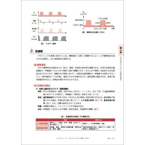 人工呼吸管理はじめの一歩 適応、モード設定から管理・離脱、トラブル