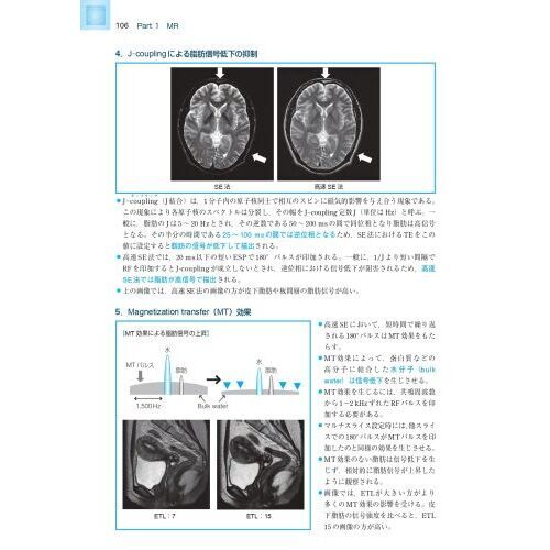 MR・超音波・眼底 基礎知識図解ノート 第2版補訂版 セット www