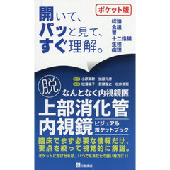 脱なんとなく内視鏡医上部消化管内視鏡ビジュアルポケットブック