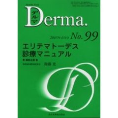 デルマ　Ｎｏ．９９　エリテマトーデス診療マニュアル