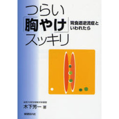 つらい「胸やけ」スッキリ　胃食道逆流症といわれたら