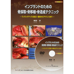 インプラントのための骨採取・骨移植・骨造
