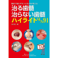 治る歯髄治らない歯髄ハイライトＱ＆Ａ９１　臨床で悩むギモンにＤｒ．泉が答える