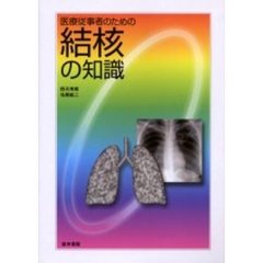 医療従事者のための結核の知識