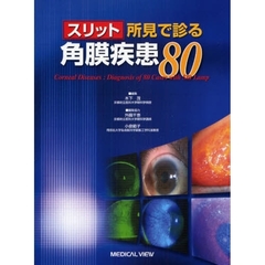 スリット所見で診る角膜疾患８０
