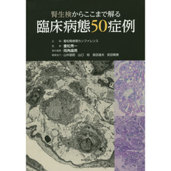 腎生検からここまで解る臨床病態５０症例