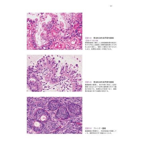 卵巣腫瘍・卵管癌・腹膜癌取扱い規約　病理編　第２版