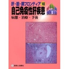 自己免疫性肝疾患　病態・治療・予後