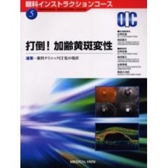 打倒！加齢黄斑変性　速報－眼科クリニックＩＴ化の現状
