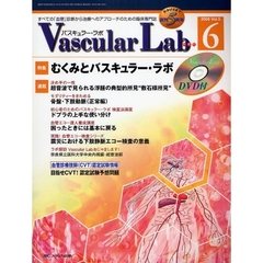 Ｖａｓｃｕｌａｒ　Ｌａｂ　すべての「血管」診断から治療へのアプローチのための臨床専門誌　第５巻６号（２００８－６）　特集むくみとバスキュラー・ラボ