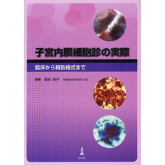 子宮内膜細胞診の実際　臨床から報告様式まで