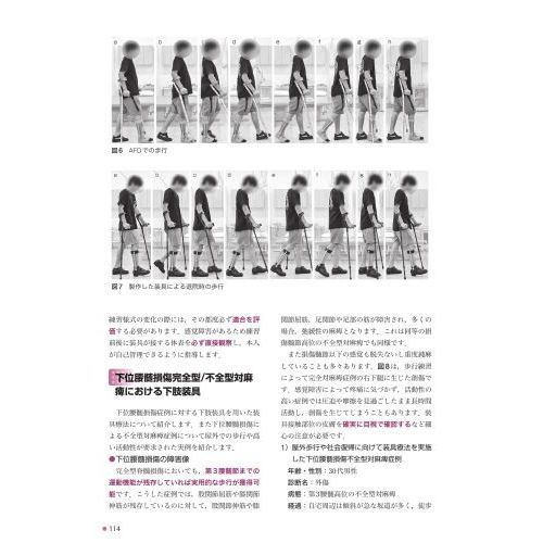 イラストでわかる装具療法 通販｜セブンネットショッピング