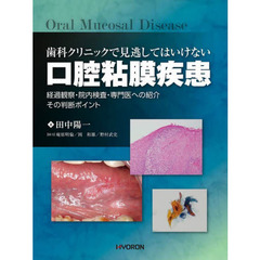 歯科クリニックで見逃してはいけない口腔粘膜疾患　経過観察・院内検査・専門医への紹介その判断ポイント