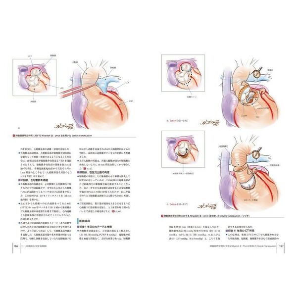 心臓血管外科手術エクセレンス 手術画と動画で伝える ５ 先天性心疾患