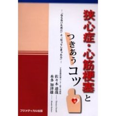 狭心症・心筋梗塞とつきあうコツ　「ならないために」と「なってしまったら」