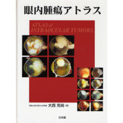 眼内腫瘍アトラス