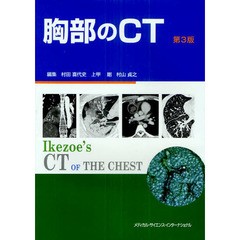 胸部のＣＴ　第３版