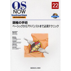 頚椎の手術　ベーシックからアドバンストまで必須テクニック