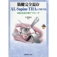 筋腱完全温存ＡＬ－Ｓｕｐｉｎｅ　ＴＨＡの手術手技　仰臥位前外側アプローチ